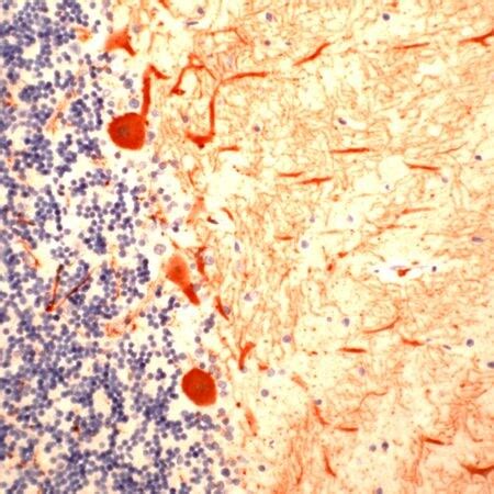 Calbindin D28K Antibody