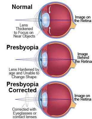 Pin on Vision Assistance Ideas