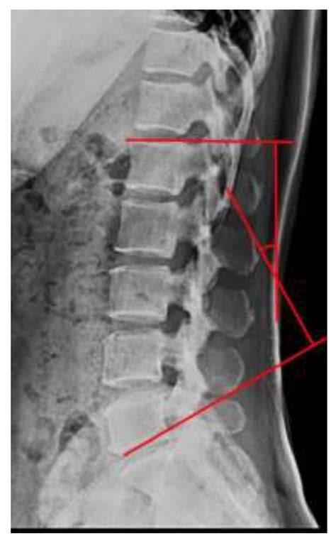 IJERPH | Free Full-Text | Effect of Different Exercise Types on the Cross-Sectional Area and ...