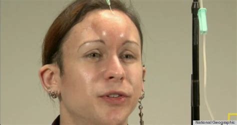 'Bagel Head' Saline Forehead Injections: Japan's Hot New Beauty Trend? (VIDEO) | HuffPost