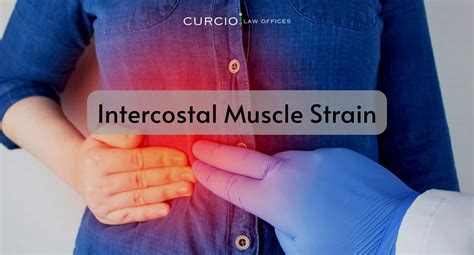 Intercostal Muscle Strain | Curcio & Casciato | Chicago, IL