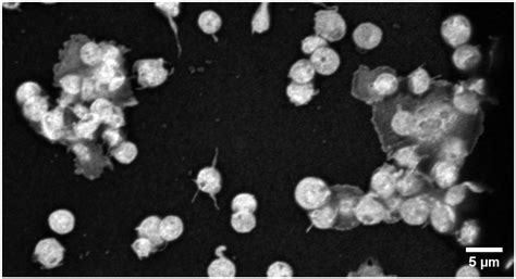 IJMS | Free Full-Text | Effect of Prostanoids on Human Platelet Function: An Overview