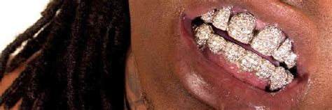 Lil’ Wayne’s Teeth are not Welcome Here | Jenny Sangster Jewellery