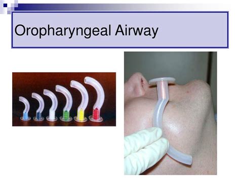 PPT - Airway Management in the Critically Ill PowerPoint Presentation - ID:749385