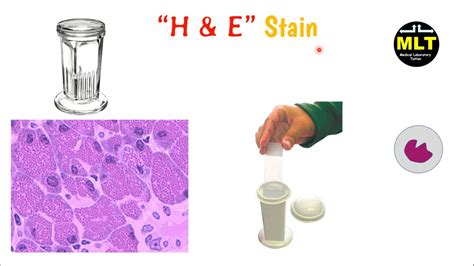 H&E Staining Protocol / Oil Red O And Hematoxylin And Eosin Staining For Quantification Of ...