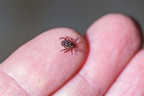 Tick-Borne Relapsing Fever - Symptoms | familydoctor.org