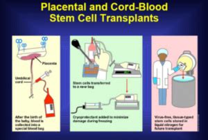 Cord Blood Banking by Tiankai Zhang - OpenWetWare