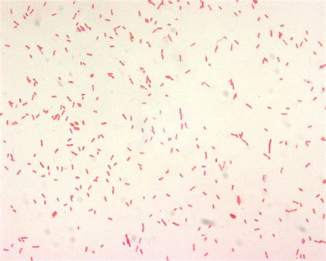 Haemophilus Influenzae Gram Stain - Pin By Nancy De Jesus Torres On Bio ...