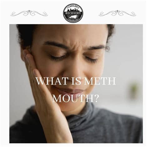 What is Meth Mouth? - Carolina Center for Recovery