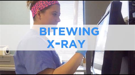 How to Perform a Bitewing X-Ray. - YouTube