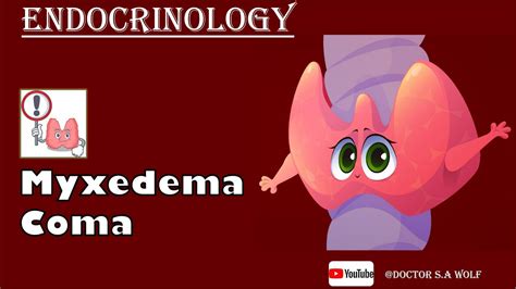 Myxedema Coma | Causes, Pathophysiology, Treatment - YouTube