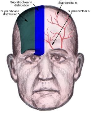 Supratrochlear Nerve Block: Overview, Anatomy, Indications