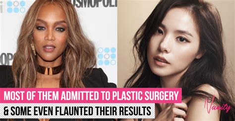 Korean Celebrity Without Plastic Surgery / Plastic Surgery In Market China How China Became The ...