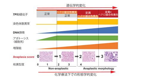 Wilms 腫瘍の予後不良なタイプ「Anaplasia histology」の発生および化学療法耐性獲得機序を解明 ～Wilms 腫瘍患者のさらなる生存率向上への布石～ - 名古屋大学研究成果情報