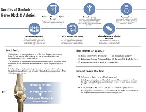 Genicular Nerve Block & Ablation - Genesis Pain Clinic