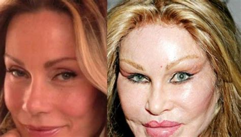 Complete Report On Jocelyn Wildenstein's Plastic Surgery: Know It All Here! | Glamour Fame