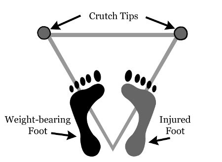 How to Walk with Crutches | MedGuidance