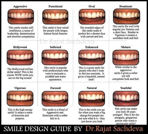 Pin on dental implant clinic