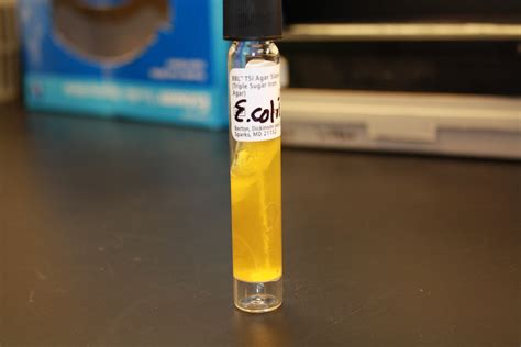 E.coli A/A, gas TSI | VeeDunn | Flickr