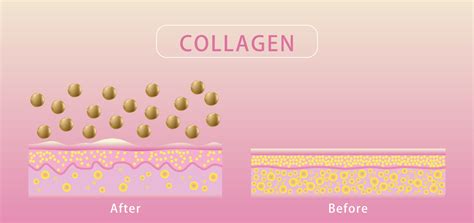 Collagen , Before and after process of getting skin, Protection Skin ...