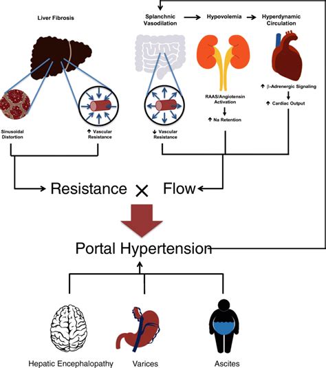 Portal Hypertension Pathophysiology