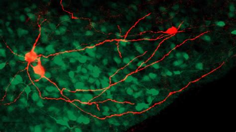 The insular cortex processes, and drives learning from pain ...