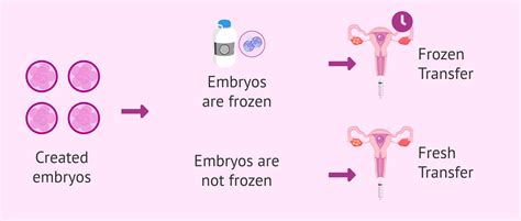 Embryo transfer types