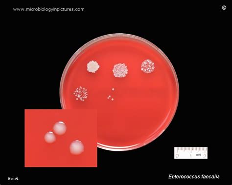 Enterococcus Faecalis Gram Stain Morphology