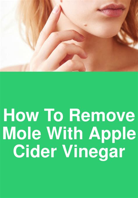 How To Remove Mole With Apple Cider Vinegar | Mole removal