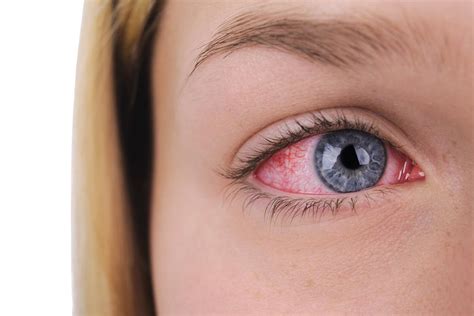 Ocular syphilis outbreak: The inflammatory eye disease that can make you go blind is on the rise ...