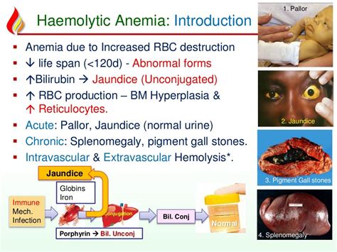 Anemia3 Hemolytic acquired