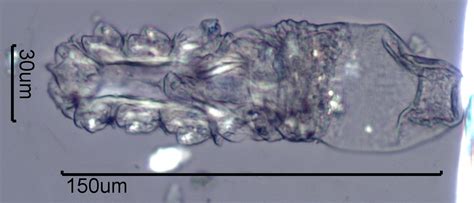 Demodex Mite Under the Microscope