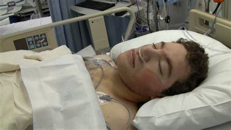 Scheuermann's disease/scoliosis surgical correction, April 2011 (spinal fusion) - YouTube