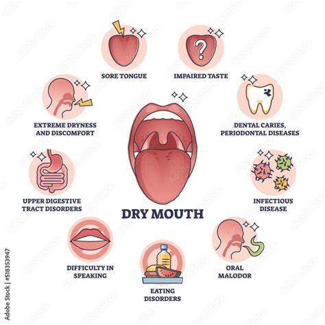 Dry Mouth And Throat Symptoms