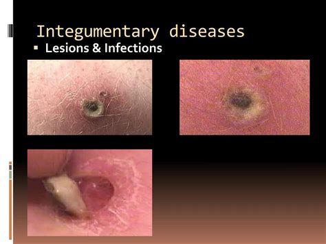 PPT - Selected Integumentary System Diseases & Conditions PowerPoint ...