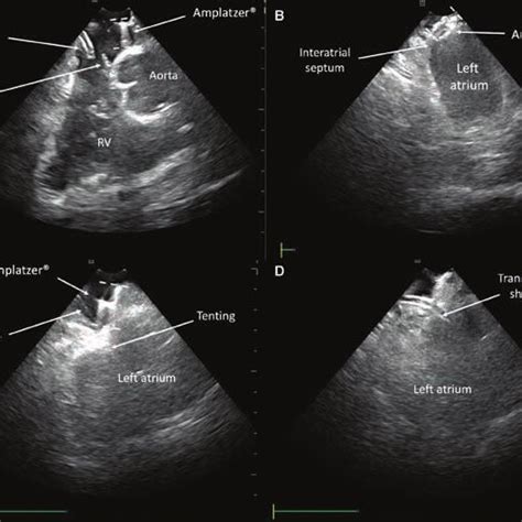 Image showing the anatomical references relevant during the procedure.... | Download Scientific ...