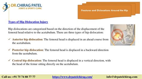 PPT - Fractures and Dislocations Around the Hip: Types & Treatment PowerPoint Presentation - ID ...