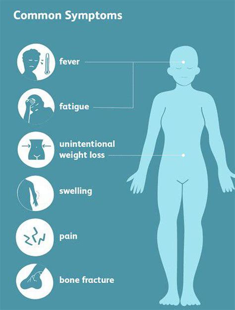 Chondrosarcoma symptoms - MEDizzy