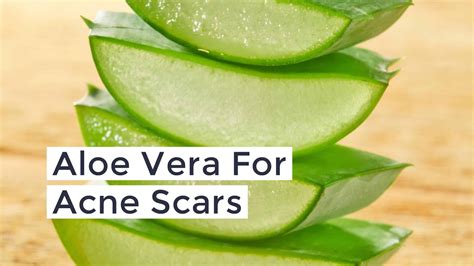 How to Clear Acne Scars using Aloe Vera