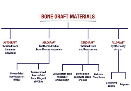 Grafting with Biomaterials - Did You Get Consent? - Oral Health Group