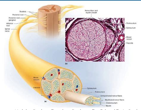 Figure 3 from Traumatic Spinal Cord Injury at T12 Causing Complete Paraplegia for 12-Years ...