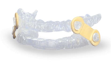 Mandibular Advancement Device - EMA® Oral Appliance