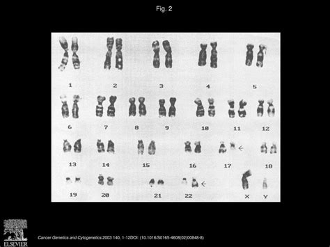 Avery A. Sandberg, Julia A. Bridge Cancer Genetics and Cytogenetics - ppt download