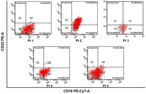 The proportion of cd19 expression in B-All cells. | Download Scientific Diagram