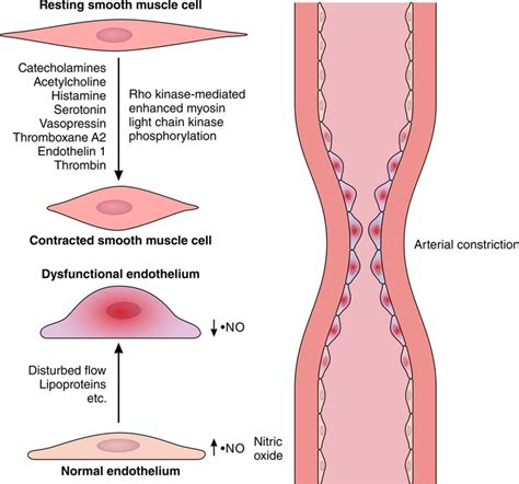 Acute Coronary Syndromes | Circulation