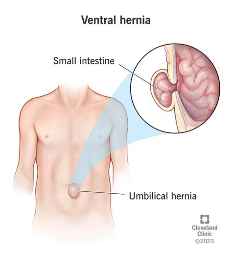 Belly Button Inside Diagram