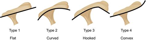 Acromion Types