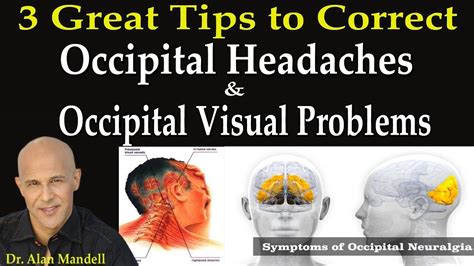 3 Great Tips to Correct Occipital Headaches & Occipital Visual Problems - Dr Mandell - YouTube ...