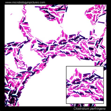 Clostridium perfringens. Clostridium perfringens Gram-stain and cell morphology. Clostridium ...