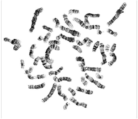 Image showing metaphase, processed metaphase and Karyotype 1